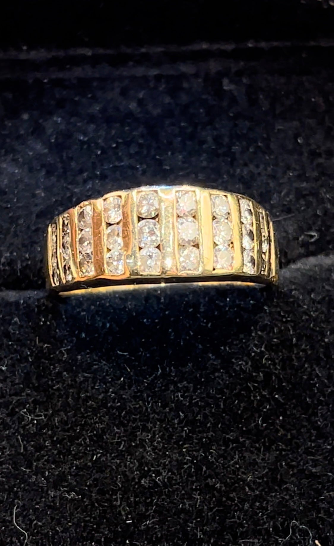 Anillo