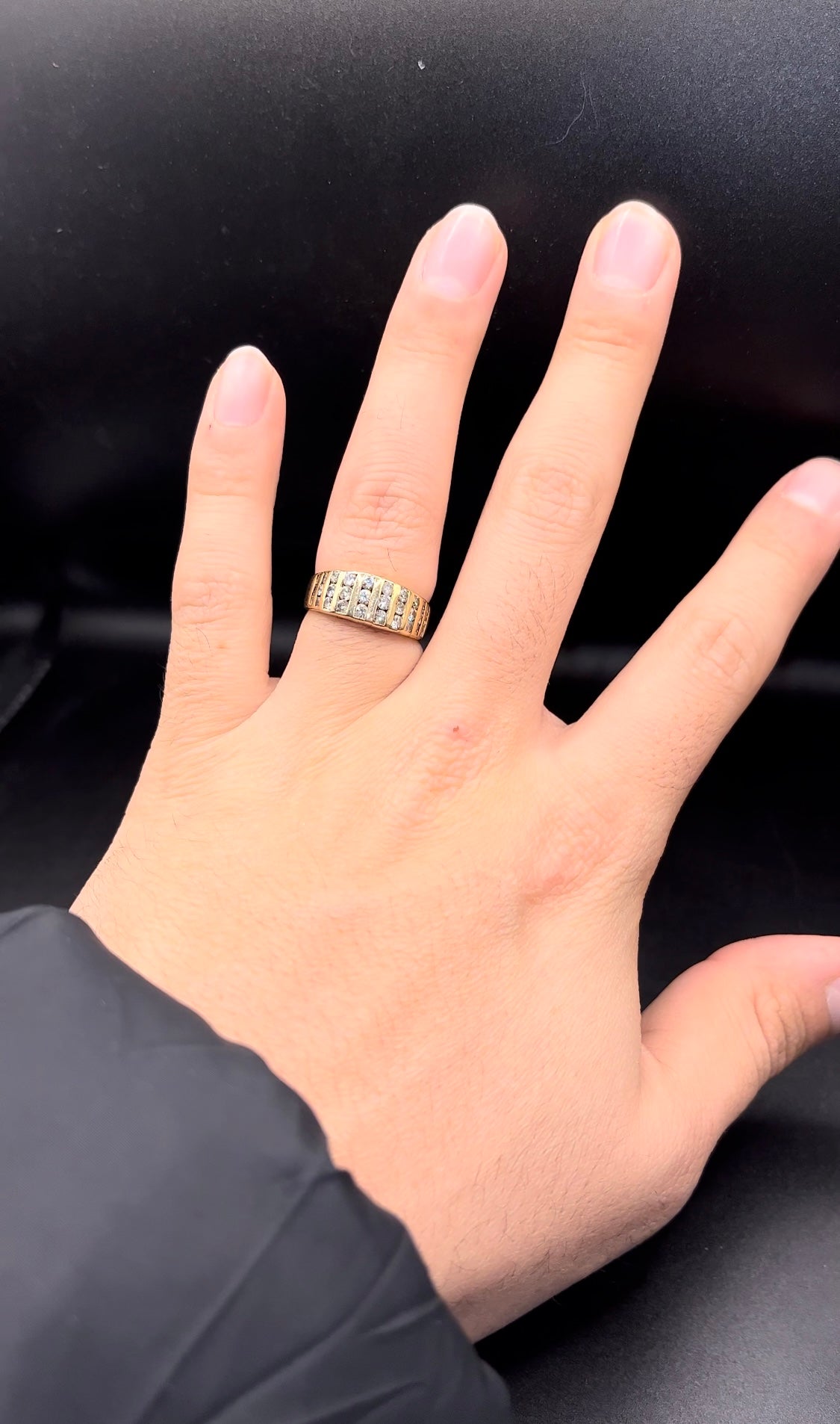 Anillo